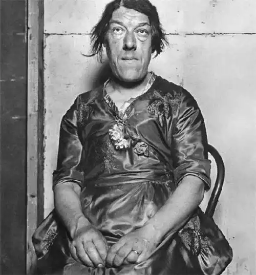 国外一位母亲,为养家放弃尊严,以被人嘲笑的容貌换取金钱