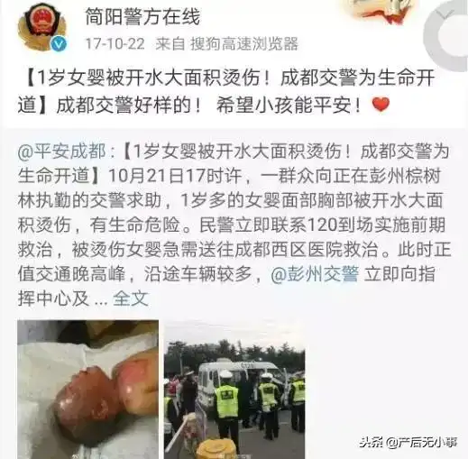 产后无小事已有多名孩子被烫伤,这些危险很多家长没注意