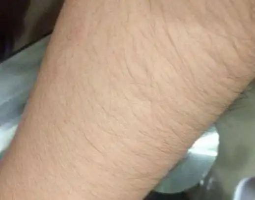 有的女性体毛比男人还旺盛,到底是什么原因用不用刮掉