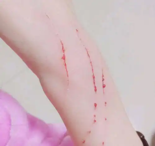 网友家小猫不知为何每次洗澡都攻击主人,让主人心痛到只能打疫苗