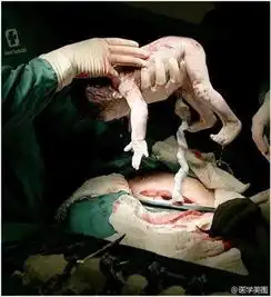 关于妇产科的45张图片,直观理解妇产科