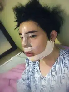 一枚韩国男纸的惊艳整容史