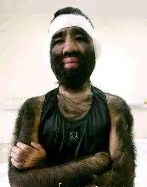 世界上最丑的男人,亚洲最少,非洲夺冠