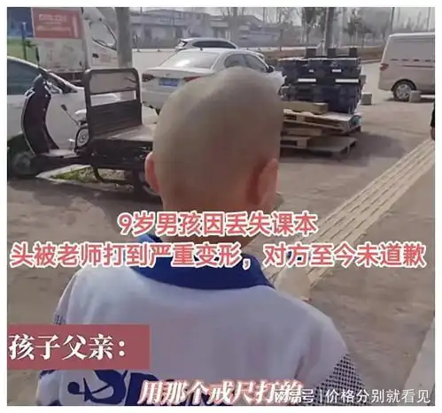 9岁男童被老师打致头部变形,索赔艰辛,学校要求以救助名义赔偿