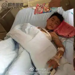 平顶山9岁男孩被熊咬掉胳膊