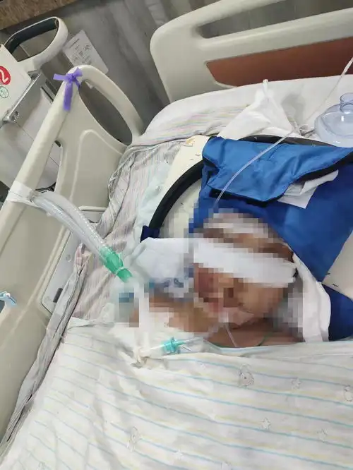 河北一男孩被跳楼者砸伤昏迷,当地官方正协调对伤者救助
