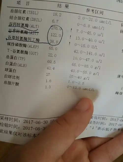 大家看看我这是不是很严重的