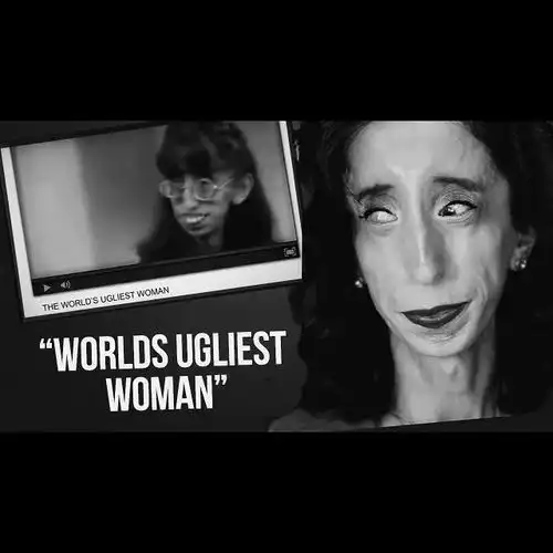 她丑到被拿来吓唬孩子,却靠嘴巴逆袭成为世界级网红