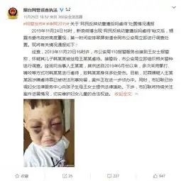 三岁男童遭继母拳打嘴咬怎配为人母人间恶魔