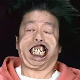 为什么日本人的牙齿这么丑