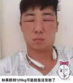 一男生拍下染发过敏全过程,脑袋肿成外星人,南宁小伙伴你怕了吗
