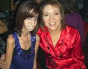 男子选丑大赛夺冠看看世界最丑的男人