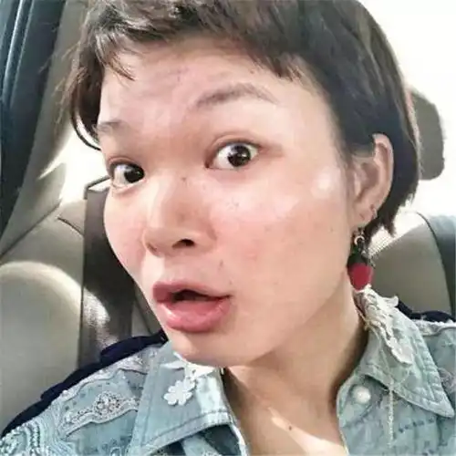 一首歌让她红遍大江南北,王思聪都点赞,却因长相太丑引发争议